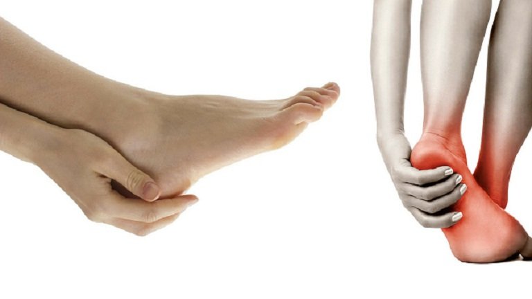 ways-of-improving-blood-circulation-in-legs